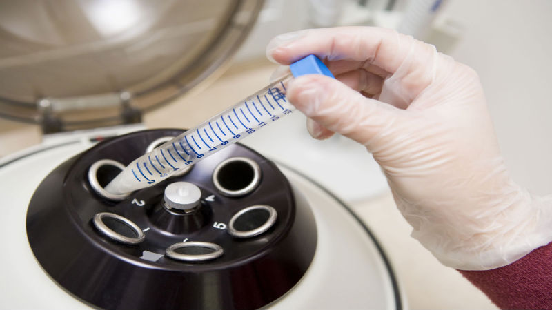 The Steps Involved In IVF In San Antonio, TX